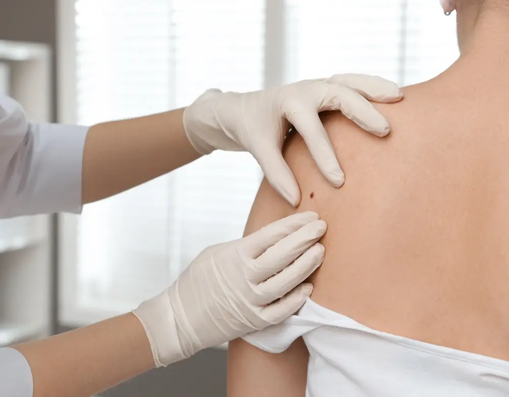 Eine Patientin beim Dermatologen