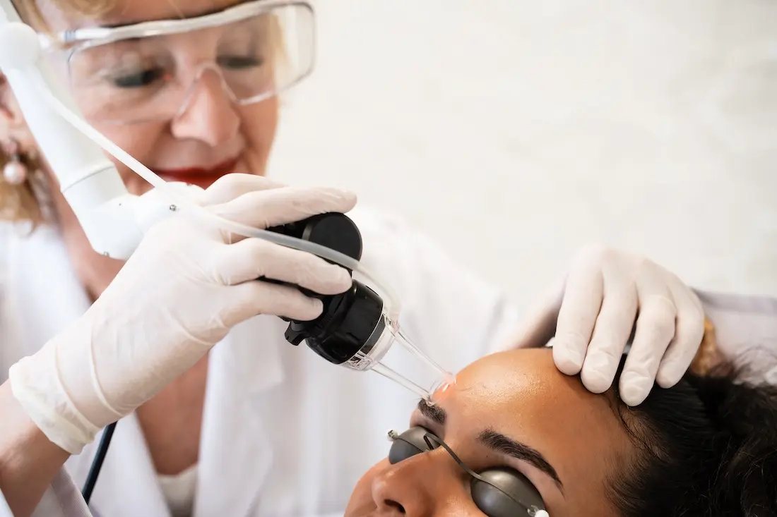 Co2 Laser Behandlung Eine Frau wird mit einem Laser behandelt